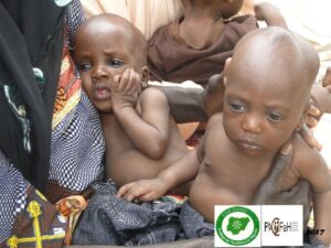 Concern at prevalence of stunted growth among children