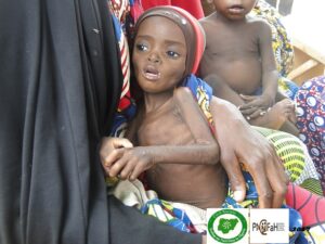 Civil Society Groups Raise Alarm over Increase Rate of Children Malnutrition